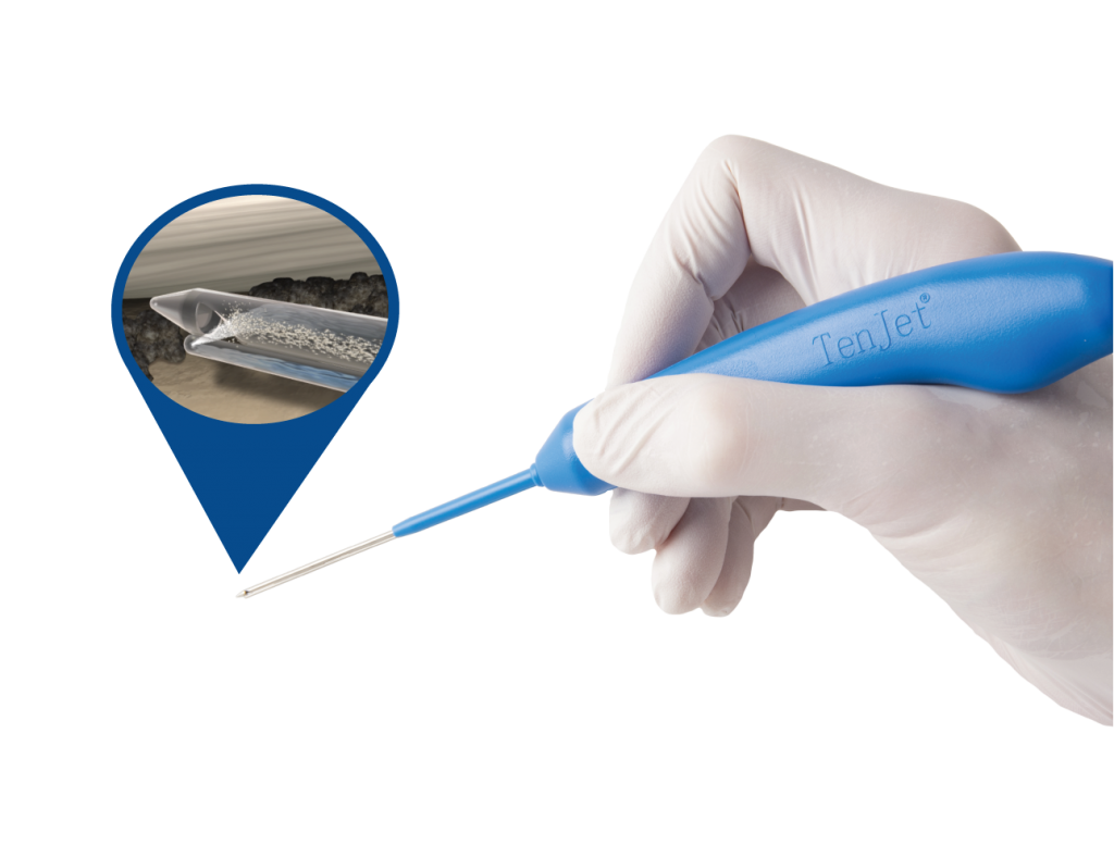 TenJet needle tip